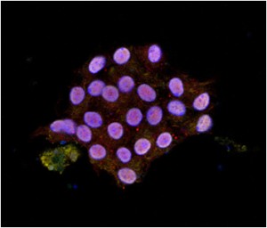 Células de tumor de Cushing teñidas con un marcador de crecimiento tumoral. Imagen: Gentileza Eduardo Arzt.