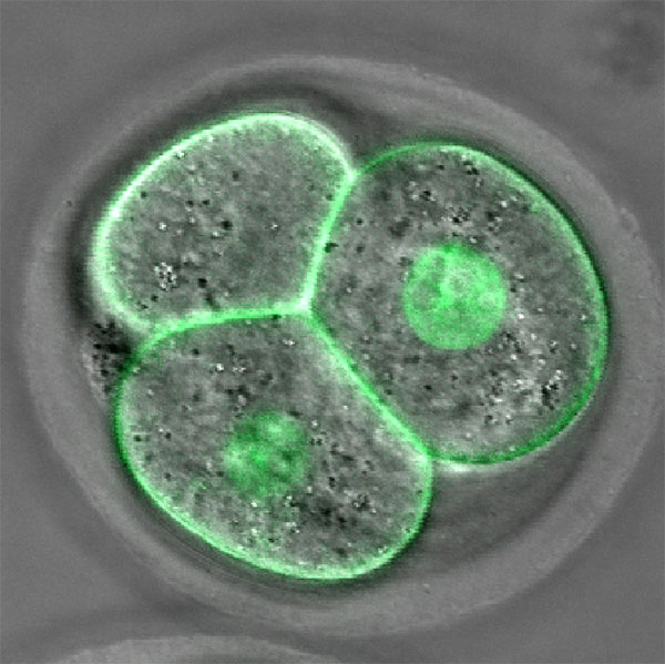 Imagen de un embrión obtenida a partir de una técnica avanzada de microscopía de fluorescencia. En verde se marcan el núcleo y la membrana de las celulas que componen el embrión. Cortesía Valeria Levi.