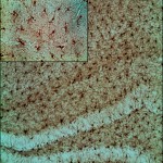 En la imagen se ven las células microgliales que participan de la respuesta inmune innata inflamatoria en el hipocampo, provenientes de cortes de cerebro de ratones alimentados con dieta grasa. En el recuadro, se ven a mayor aumento y se observa su morfología, que puede cambiar en función de la condición del ratón, aumentando su estado de activación.