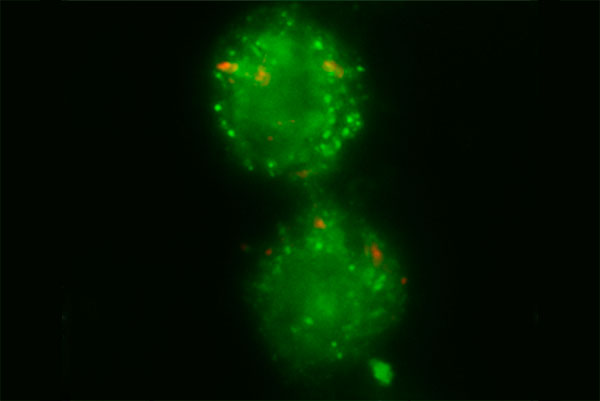 Monocitos de pacientes con tuberculosis, infectados con la micobacteria (en rojo) causante de tuberculosis. En verde se ven las estructuras punteadas, indicativas de la autofagia.