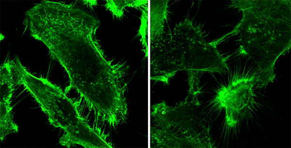 En ambas imágenes se observan células tumorales prostáticas teñidas con una sustancia que pone en evidencia las prolongaciones celulares o filopodios.
