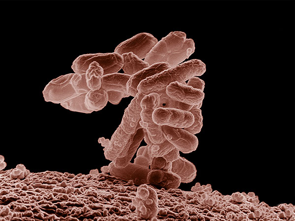 Escherichia coli. Foto: Eric Erbe. USDA, ARS, EMU.