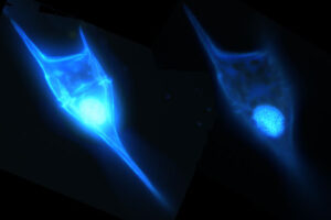 Dinoflagelado planctónico (observación bajo microscopio de fluorescencia)