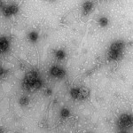 Imagen obtenida a partir de microscopía electrónica que muestra un campo con varios fagos que infectan bacterias lácticas.