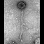 Imagen de microscopía electrónica en la que se observa la estructura de un fago.