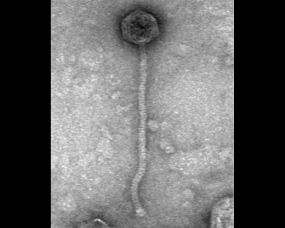 Imagen de microscopía electrónica en la que se observa la estructura de un fago.