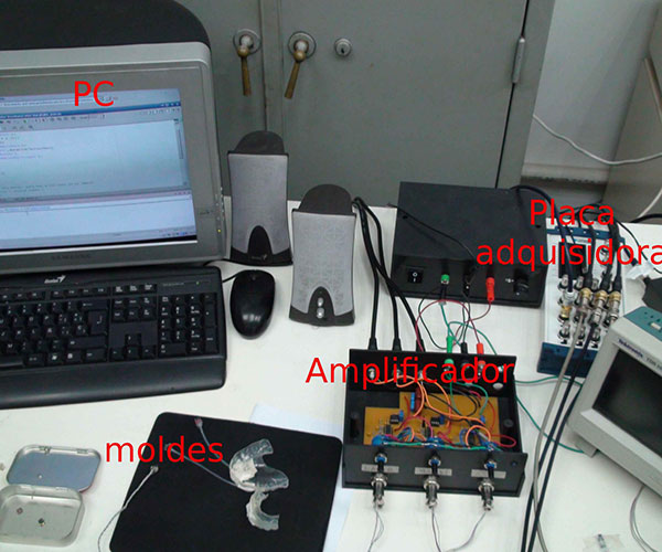 Conjunto de equipos utilizados por los investigadores para producir la voz sintética.