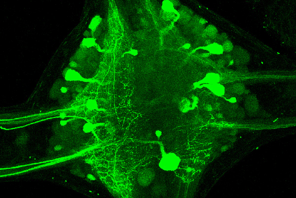 Esta imagen muestra el conjunto de neuronas motoras en un ganglio de una sanguijuela. Se trata del tipo de neuronas que el animal usa durante el comportamiento estudiado.