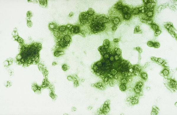 Imagen del virus de Dengue obtenida con un microscopio electrónico. Foto: Sanofi Pasteur. Institut Pasteur