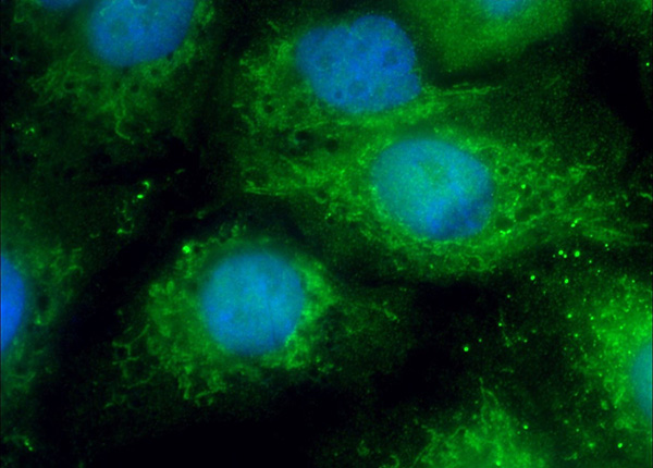 Proteína MX1 (imagen de microscopía de fluorescencia).