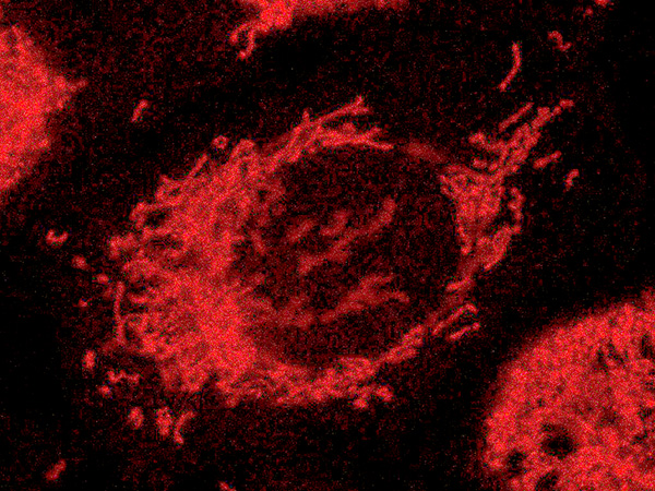 Imagen de microscopía de fluorescencia de células tumorales prostáticas humanas teñidas con un colorante rojo que permite visualizar las mitocondrias funcionalmente activas.