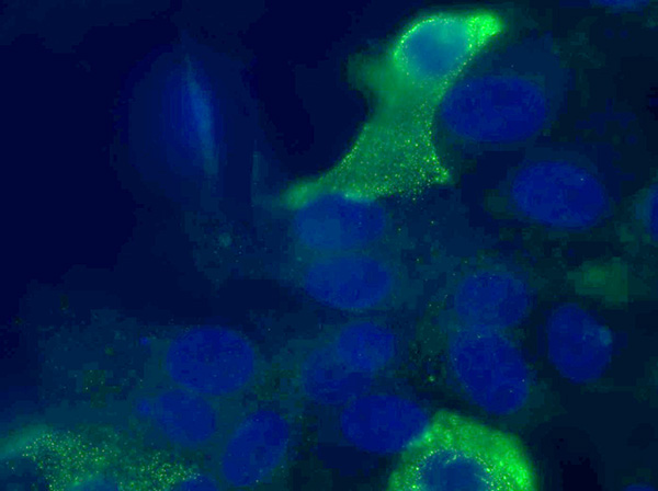 Imagen de microscopía de células infectadas por el virus Zika.